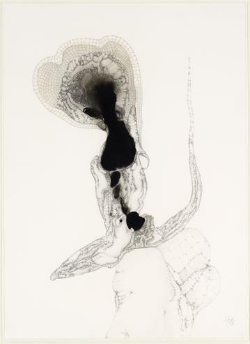 Fred Deux, La Patiente, 1972. Don de Alain Margaron Image © Lyon MBA –Photo Alain Basset